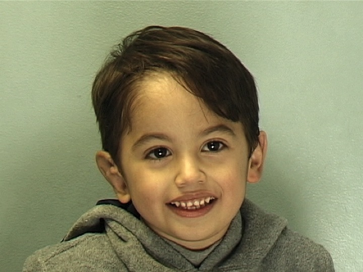 Patient 1 - After Surgery