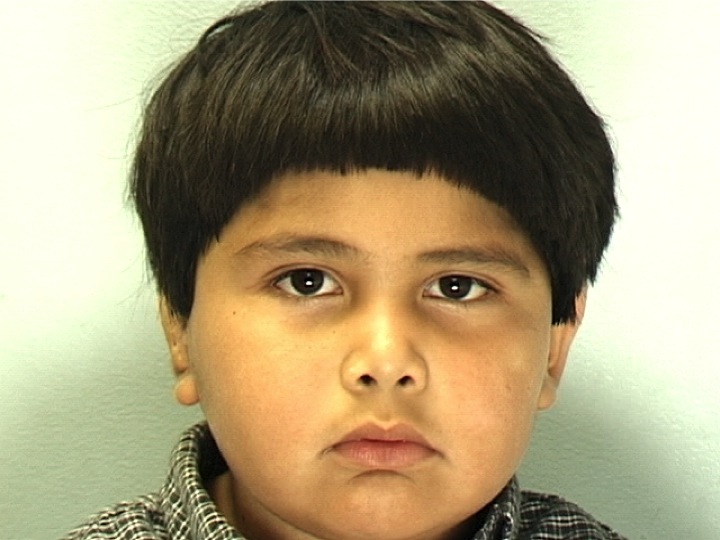 Patient 2 - After Surgery